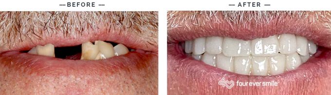 jimmy 680x196 1