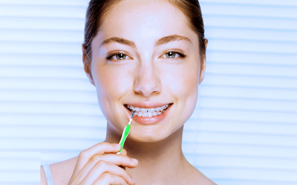 Dentist Near Me Totowa NJ 38 3D digital scan of the teeth used for precise orthodontic planning and creation of custom aligners