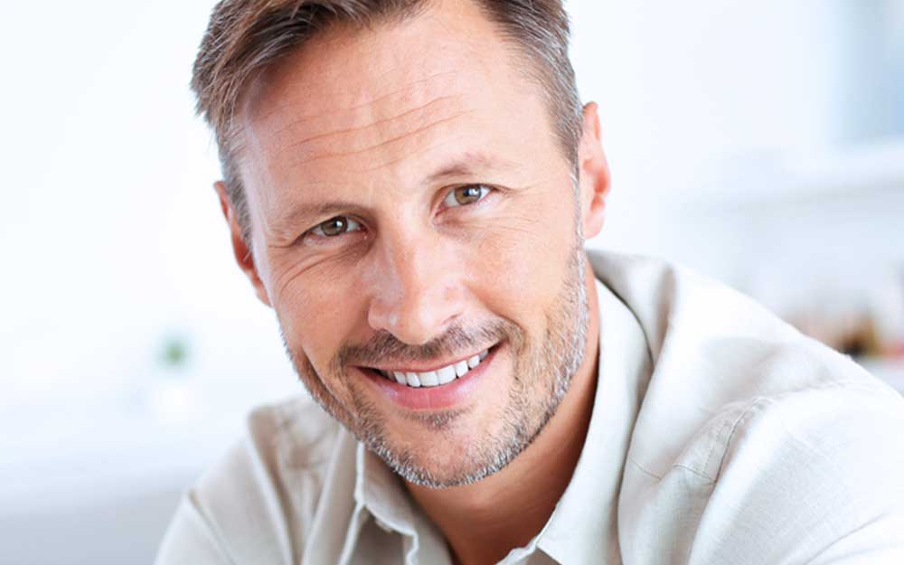 Dentist Near Me Totowa NJ 49 full mouth reconstruction showing a dramatic transformation using crowns, implants, and restorative dentistry to rebuild a healthy, functional smile.