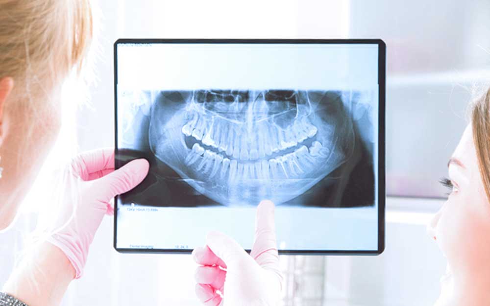 Dentist Near Me Totowa NJ 43 High-resolution digital dental X-ray providing clear visualization of tooth structure, roots, and surrounding bone